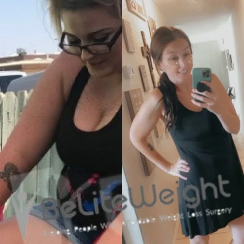 Katelynn B - 2 Year Update*